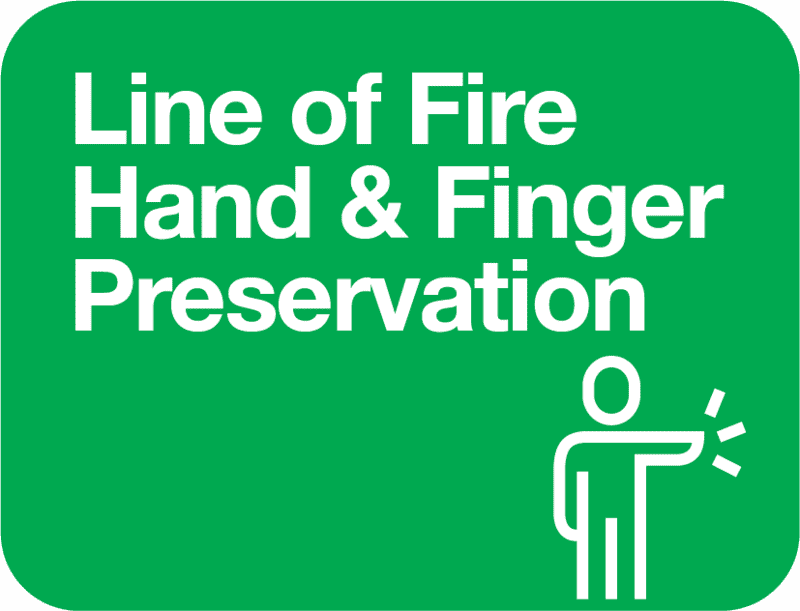 LOF.hand.and.Finger.Preservation.png